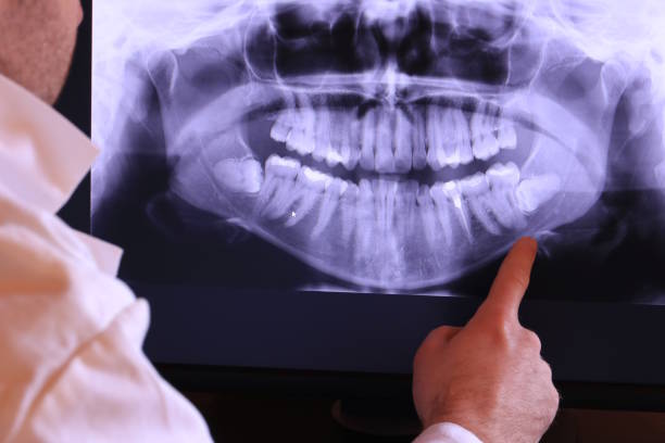 Best Dental Abscess Treatment in Flower Mound, TX